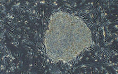 Imagen de una célula pluripotente inducida, o iPS.